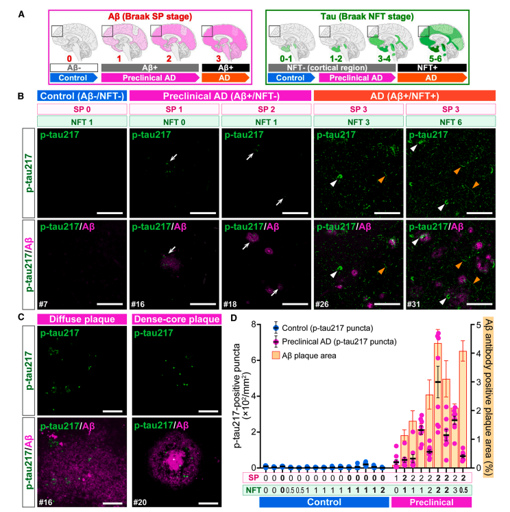 Figure 1A-D: p-tau217 in AD continuum