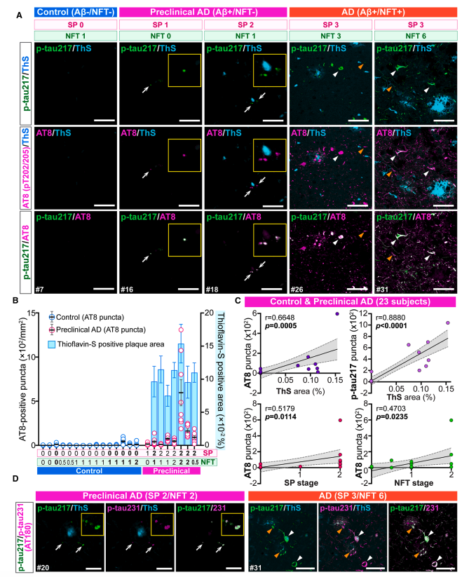 Figure 2: p-tau217 colocalization with AT8 and p-tau231