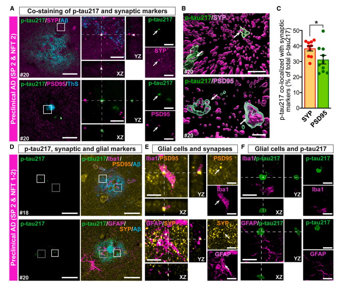 Figure 4A-F: Synaptic markers and glial cells
