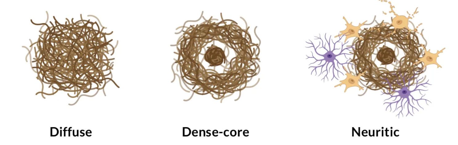 Aβ plaque maturation stages